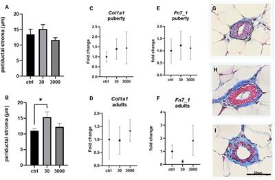 Exposure to Low Doses of Oxybenzone During Perinatal Development Alters Mammary Gland Stroma in Female Mice